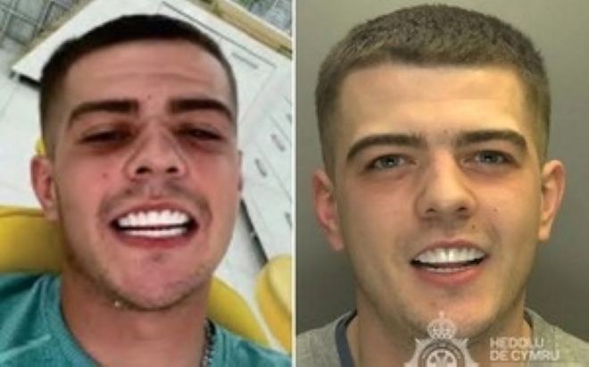 Tội phạm buôn ma túy bị bắt vì gửi ảnh khoe răng 