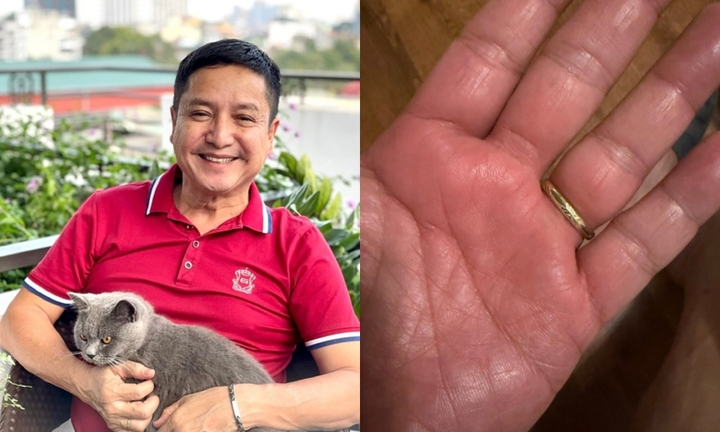 NSƯT Chí Trung mắc bệnh lạ hơn 6 tháng