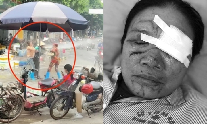 Vụ người phụ nữ dùng vòi nước cao áp xịt người bán rau ở Phú Thọ: Sức khỏe nạn nhân hiện ra sao?