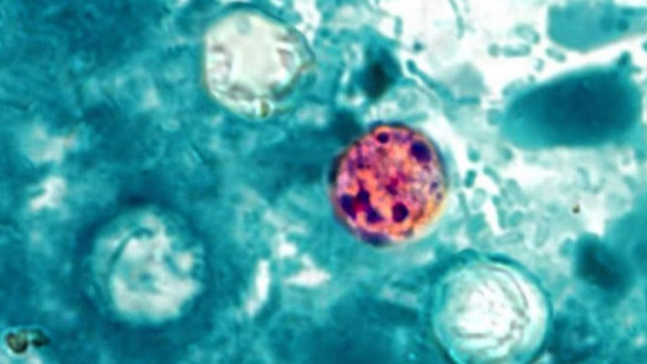 Mỹ ghi nhận những ca tử vong đầu tiên do ký sinh trùng Cyclospora