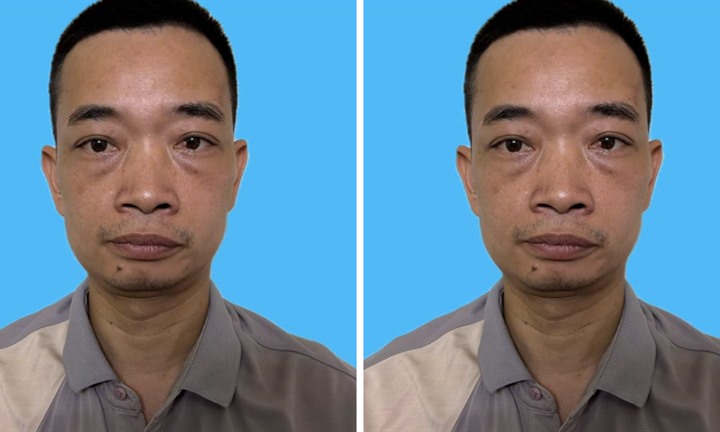 Khởi tố người đàn ông đi xe máy, chuyển hướng từ vỉa hè xuống đường gây tai nạn chết người
