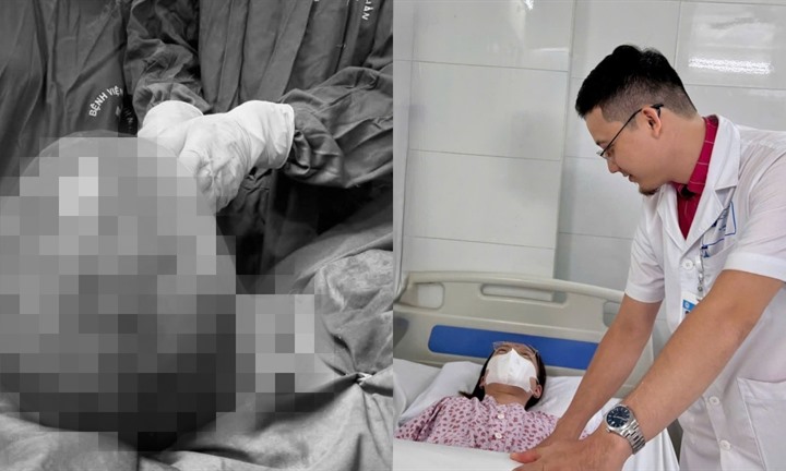 Tưởng tăng cân ở tuổi tiền mãn kinh, người phụ nữ phát hiện  "bất thường " ở ổ bụng