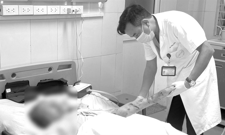 Hà Nội: Hai người cao tuổi nhập viện với chấn thương nặng do chó nhà tấn công