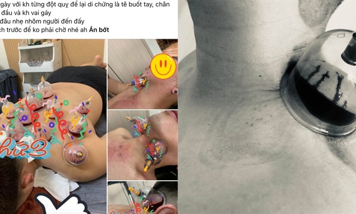 Cảnh báo trào lưu giác hơi phòng, chống chữa đột quỵ: Lời truyền miệng có thể đánh đổi bằng tính mạng