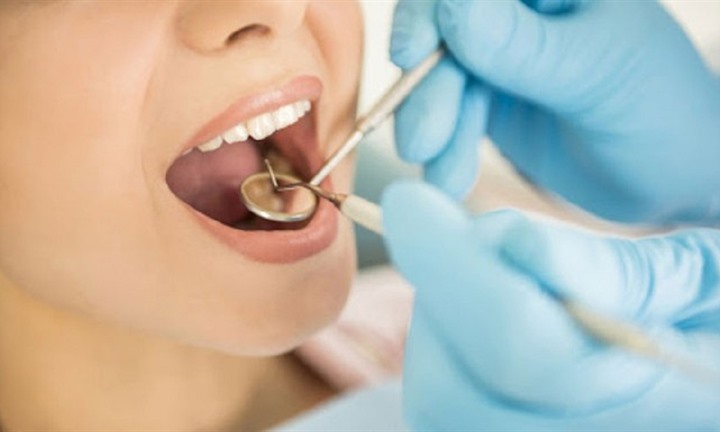 Dịch vụ lấy cao răng có được hưởng bảo hiểm y tế hay không?