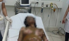 Vụ chồng tẩm xăng đốt vợ và con trai: Người vợ đã tử vong