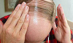 Phát hiện gien tái tạo tóc, da