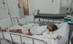 Giận chồng không tắm, thai phụ tưới dầu hoả tự thiêu