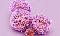 Bước đột phá diệt tế bào ung thư di căn