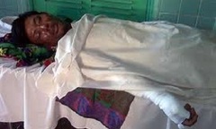 Đắk Lắk: Một phụ nữ mang thai 7 tháng nguy kịch do bỏng xăng 