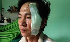 Giả cảnh sát kiểm tra giấy tờ để cướp