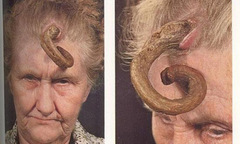  "Bí ẩn " những chiếc sừng mọc trên...đầu người