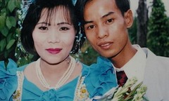 Người đàn ông mang hình hài của… cóc