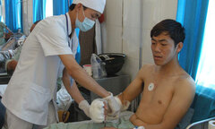 Nối thành công bàn tay bị khỉ cắn đứt