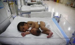 Xót thương bé sơ sinh có đầu mọc ở bụng