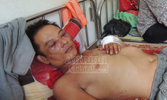 Hà Tĩnh: Nhóm côn đồ chặn đầu xe, đánh tài xế nhập viện