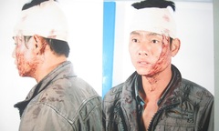 Dân tố bị công an xã hành hung, chính quyền làm ngơ