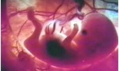 Hành trình loại bỏ PCB tại VN- Kỳ 2 Phơi nhiễm & hệ lụy