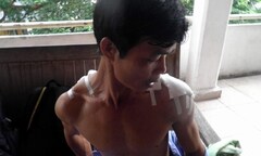 Giám đốc công ty chở côn đồ tới chém người 