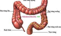    Cơ hội mới cho người bị bệnh viêm đại tràng