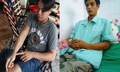 Nghi vấn công an đánh, ép dân nhận tội