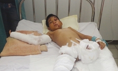 Khát khao được “mọc chân” của cậu bé mồ côi cha