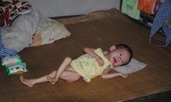 Gia cảnh khốn khó của cháu bé một tuổi bị bệnh tim bẩm sinh