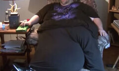 Người đàn ông mang khối u hơn nửa tạ đúng chỗ “hiểm”