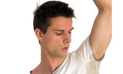 Hỏi Đáp Về Bệnh Hôi Nách