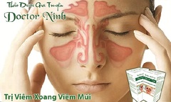 Bài thuốc trị khỏi viêm xoang, viêm mũi xoang trong 3 tuần