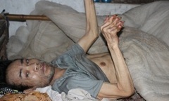 Chồng liệt giường, vợ con mắc bệnh tâm thần