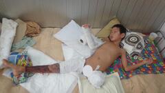 Cậu bé mồ côi 11 tuổi bị xe tải nghiền đứt lìa chân cầu cứu