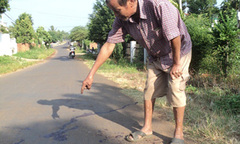 Bị côn đồ chặn đánh, nam thanh niên đứt lìa bàn tay