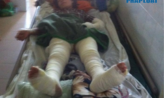 Một phút bất cẩn, cả gia đình nguy kịch