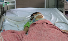 Ăn sắn cao sản nướng, bé trai bị hôn mê