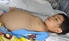 Không có tiền thay van tim, bé 3 tuổi nguy kịch từng ngày