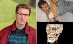 Sống sót kỳ diệu sau khi hộp sọ bị vỡ thành 30 mảnh