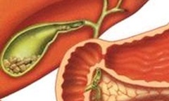 Kim Nguyên Tan Sỏi Hoàn điều trị sỏi thận sỏi mật