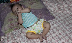 Xót thương bé trai 3 tháng tuổi mắc bệnh tim bẩm sinh