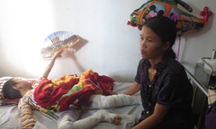 Sức khỏe cháu bé bị cha châm lửa đốt chuyển biến xấu