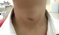 Một bé trai 7 tuổi suýt chết vì rèm cửa thít chặt cổ