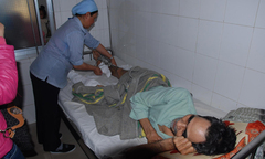 Chế thuốc nổ đánh cá, 1 người bị dập nát hai chân