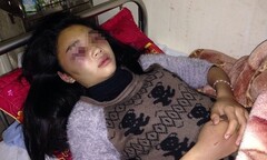 Vụ nữ sinh lớp 10 bị đánh ở Hà Tĩnh: Gia đình tiếp tục gửi đơn kiến nghị