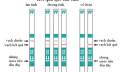 Mách bạn gái cách dùng que thử thai chính xác