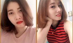 Đừng nâng mũi S line, bạn sẽ “lột xác” đó!