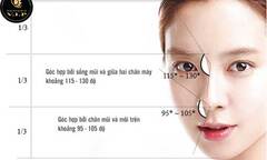 Mũi cao chưa chắc đã đẹp