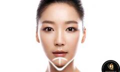 Giải quyết cằm ngắn lẹm chỉ trong 45 phút