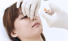 Thông tin về nâng mũi Filler tại V.I.P