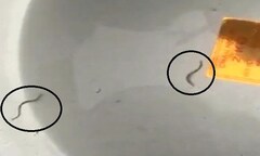 Uống nước máy có giun đỉa, sức khỏe người dân sẽ ra sao?