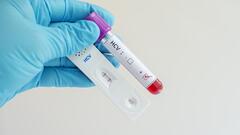 Viêm gan C:  "Tử thần " không ngờ tới